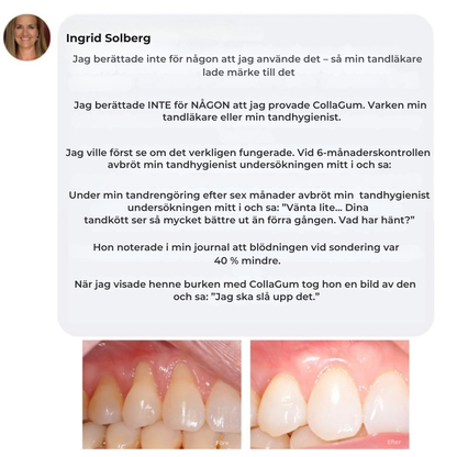 CollaGum™ | Stärk tandköttet inifrån och bevara ditt naturliga leende