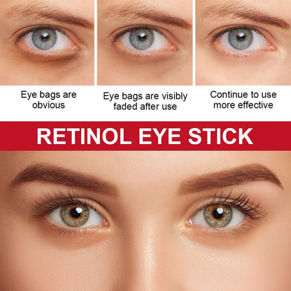 RetinGlo™ – Hudvård med Retinol för Fastare Hud | Skavera