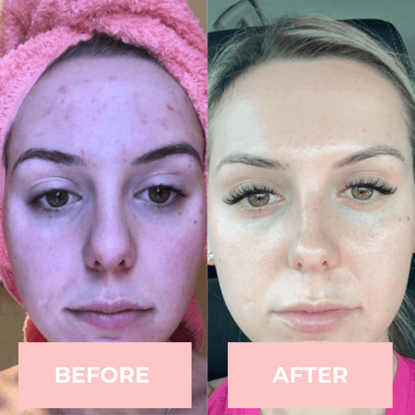 FaceTone™ – Ansiktsmassage för Stram & Ungdomlig Hud | Skavera