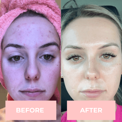 FaceTone™ – Ansiktsmassage för Stram & Ungdomlig Hud | Skavera