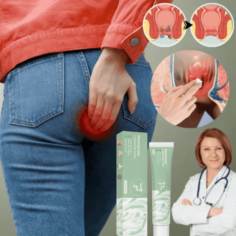 HemoLind™ – Örtbaserad hemorrojderkräm | Behandlar 99 % av hemorrojder från första appliceringen!