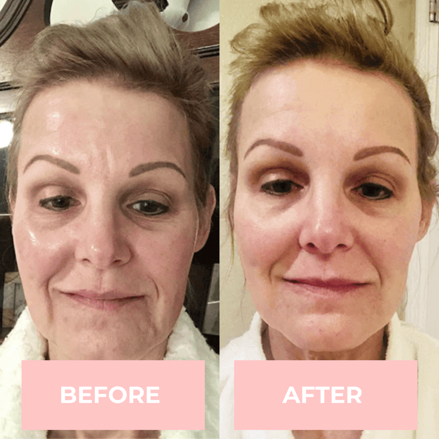 FaceTone™ – Ansiktsmassage för Stram & Ungdomlig Hud | Skavera
