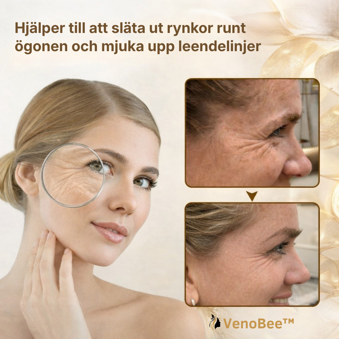 VenoBee | Minska synligheten av rynkor med upp till 98 % på bara 17 minuter